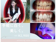 ガーディー(GaDaY)