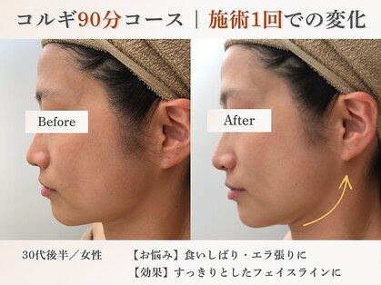 エルマ(elma)の写真