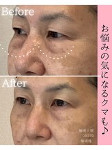 ココロ(COCORO)/目元にクマ・たるみケア♪