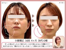 グレースエール トータルビューティーサロン(Grace Aile)の雰囲気（一時的な変化で終わらせない【 戻らない小顔 】を叶えます♪）