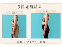 ネイト ワックス(Neit Wax)/横顔美人へ♪
