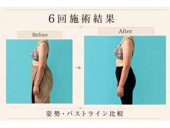 ネイト ワックス(Neit Wax)/横顔美人へ♪