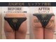 美尻研究所 ラミレ 倉敷店(RAMIRE)の写真