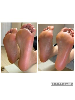 ケイブランシュ(K.ブランシュ)の写真/フットケアで角質ケアつるすべかかとに♪仕上げは膝下までのトリートメント付きで極上のリフレッシュを★