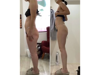 プラチナアース 守谷店(Platinum earth)/痩身ビフォーアフター