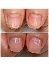 カルカルフット アンド カルネイルサロン(Karu karu foot & Karu nail salon)/ケアで自爪育成【3ヶ月コース】