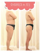 ココロ(COCORO)/全6回痩身　ビフォーアフター