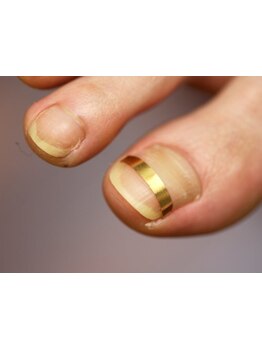 爪の悩みを解消できる（ケア含む）