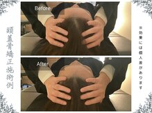 ボディ リセット アンド デザイン(Body Reset & Design)/【施術例】ビフォーアフター