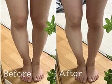 ヨサパーク 茉莉花(YOSA PARK)の雰囲気（深部リンパ×厳選ハーブ温浴でみるみる細く薄くなる！感動体験！）