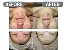 インフィニート 上野毛(infinito)/★BEFORE/AFTER★