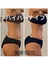 ルヴェール 久屋公園(le verre)/ハイパーナイフ全身