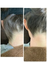 エン(en.)/BeforeAfter写真48