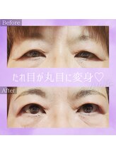 コトリ(kotori)/アイリッドアップパーマ