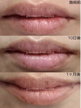 テセラ(Tethere)/ローマピンク