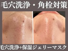 マヴィ 高槻店(MavY.)/毛穴洗浄×高保湿