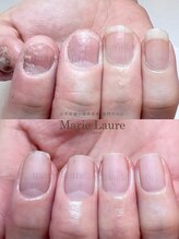 マリーロール 淀屋橋本店(Marie Laure)/深爪矯正/自爪育成/ネイルケア