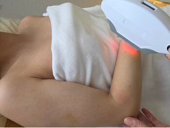 サロン ジョリ(Salon Jolie)の写真/美肌脱毛でムダ毛をなくして、ワントーン明るい素肌に♪完全個室のプライベート空間で、初めての方にも◎