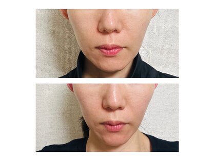 ヨサパーク エルソル(YOSA PARK)の写真