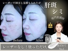 The水光美肌専科