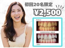 ホワイトニングショップ 守口店