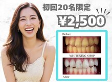 ホワイトニングショップ 守口店