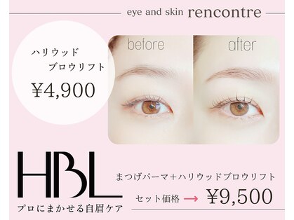 ランコント(rencontre)の写真