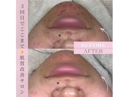 シェリエ(Sheller)の写真