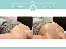 美人バスト 那覇店/バストアップ・育乳◆症例◆