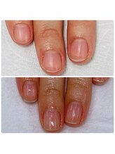 カルカルフット アンド カルネイルサロン(Karu karu foot & Karu nail salon)/ケアで自爪育成【3ヶ月コース】