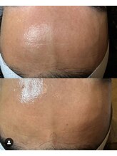 叶(Kanau)/プロセルセラピーズ