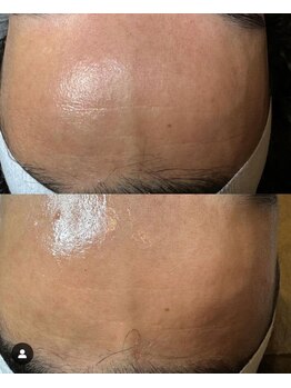 叶(Kanau)/プロセルセラピーズ