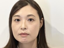 トミー(Tommy)/まつげパーマ