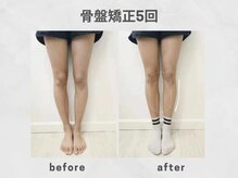 ビトリア 小顔 骨盤美容矯正サロン(BITORIA)/骨盤胸椎矯正