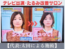 小顔ドクター