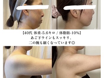 ヨサパーク アーバンヘブン 目黒(YOSA PARK Urban Heaven)/短期期間で集中ダイエット!