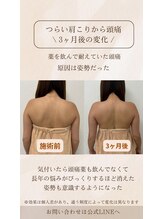 ミュリール 根津店(Murir)/