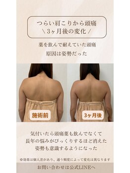 ミュリール 根津店(Murir)/