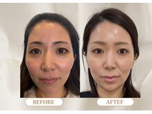 トロワ(TROIS)/第三の選択