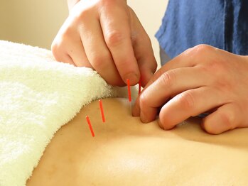 びわの葉治療院/しつこいコリと不調に