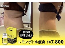 ミラヴィエ(Miravie)