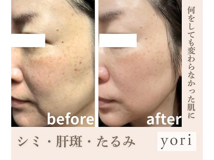 ヨリ(yori)の写真