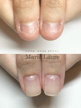 マリーロール 梅田店(Marie Laure)/深爪矯正/自爪育成/自爪風