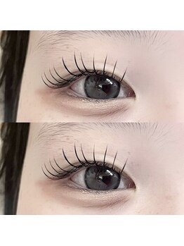 エムズプラス(M’s+)/フラットラッシュ100本