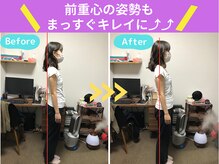 京都中丸整体カイロプラクティック/不良姿勢