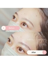 シャルトルズ 広島八丁堀店/症例写真１