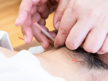 一二三はりきゅう院/鍼灸/眼精疲労/肩こり/頭痛