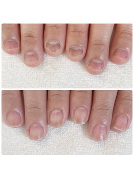 ココモ(cocomo)の写真/【自爪を美しく◎】自爪育成で生涯美爪!ジェルを使わないケアで爪の悩みを解消・最強ネイルケア技術!