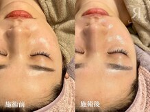 ポノ(Pono)/うる艶な素肌へ