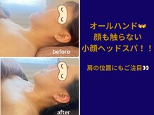 ベリル(BERYL)/【横顔美人になれる】たるみ改善